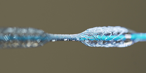 Test of a medical stent. Mesh metal nitinol self-expandable stent for endovascular surgery